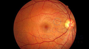 Retina